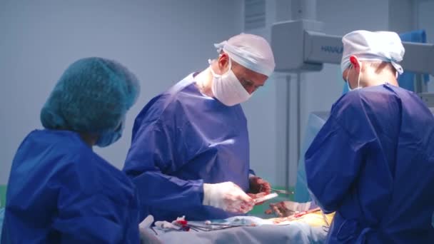 Ett Team Kirurger Operationssalen Läkare Som Opererar Patienter Läkarens Händer — Stockvideo