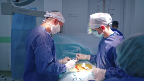 Profesionální Chirurgové Obsluhují Pacienta Operační Procedura Moderní Klinice Skupina Zdravotníků — Stock video