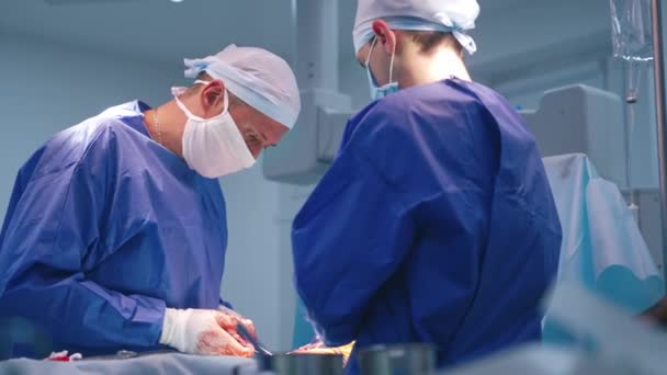 Modern Ameliyathanede Ameliyat Ameliyat Sırasında Eldiven Kanla Doktorun Elleri Hastanede — Stok video