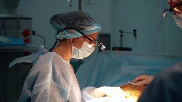腹部整形手术 手术室里的团队外科医生 手术室的现代化设备 — 图库视频影像