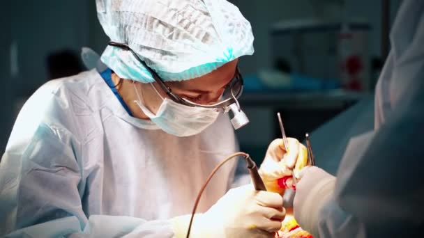 Γυναίκα Χειρουργός Στο Χειρουργείο Αντανάκλαση Στα Γυαλιά Σύγχρονος Εξοπλισμός Στο — Αρχείο Βίντεο
