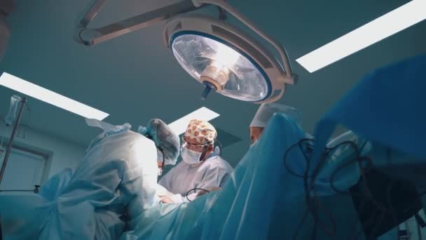 Médicos Profesionales Cirugía Plástica Quirófano Abdominoplastia Del Abdomen Corrección Corporal — Vídeo de stock