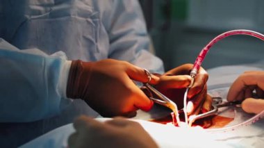 Nörocerrahlar klinikte ameliyat yapıyorlar. Tıbbi aletler kullanan bir hemşire ve cerrahın elleri. Ameliyat sırasında tüplerdeki kan akışı. Yakın plan..