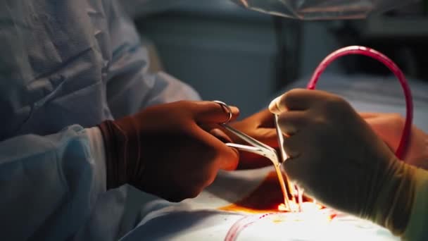 Χειρουργείο Χέρια Ενός Γιατρού Που Εκτελεί Μια Επέμβαση Ιατρικό Εργαλείο — Αρχείο Βίντεο