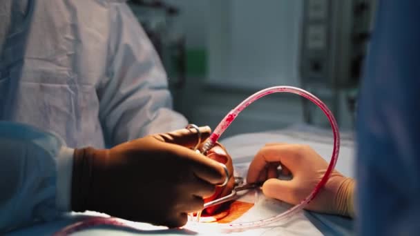 Neurokirurgi Operationer Som Utförs Specialister Läkarens Händer Sterila Handskar Som — Stockvideo