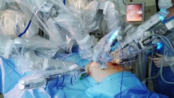 フューチャー手術 現代の医療機械のロボットアームは 外科室の患者に対して手術を行います 医学における新しい技術 — ストック動画