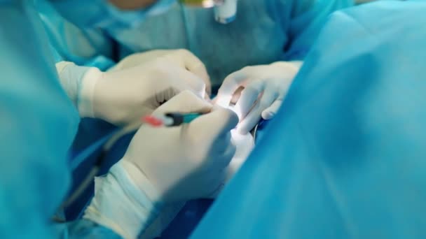 無菌手袋の医師と看護師の手を握っています 手術中に医療機器を保有する外科医 クローズアップ — ストック動画