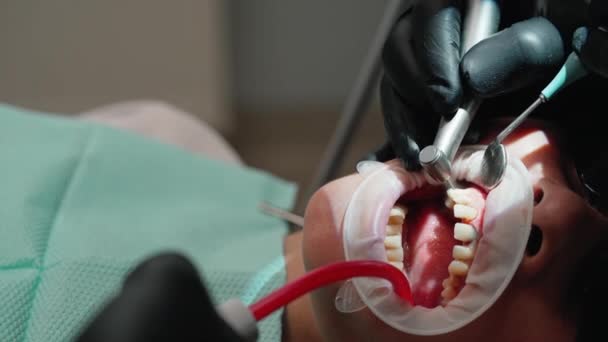 Tandbehandling Kvinnlig Patient Som Behandlar Sin Tand Tandläkarens Kontor Händer — Stockvideo