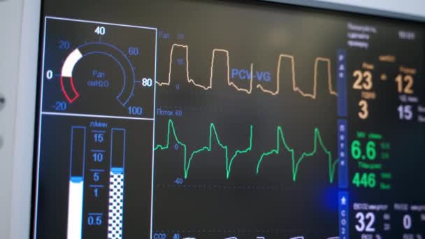 Sztuczny Monitor Wentylacji Płuc Oddziale Intensywnej Terapii Szpital Sala Operacyjna — Wideo stockowe