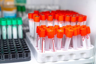 Kan için laboratuvar konteynırları. Kan test tüpleri yığını.