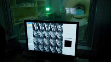 Radyoloji röntgeni bilgisayar ekranında. Monitör hastanın tarama sonuçlarını gösteriyor. Hastanede röntgen cihazı var. Klinikteki doktorların işyeri. Sağlık Hizmetleri.