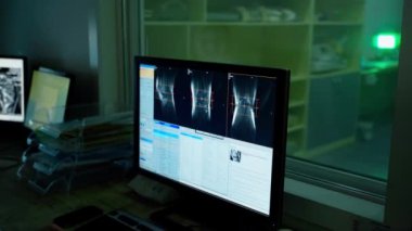 Laboratuvar odasındaki bilgisayar ekranında röntgenler. Doktor radyoloji uzmanı ekranda hastanın kemiklerinin radyografik görüntülerini inceliyor..