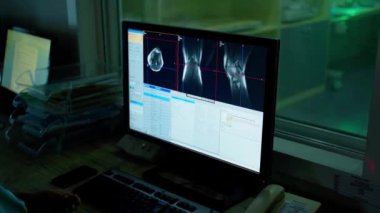 Tıbbi uzman hastanın kemiklerini monitörde inceliyor. Kadın doktor, klinikteki bilgisayar ekranında bir hastanın taramalarına bakıyor..