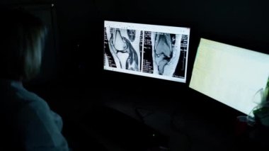 Doktor radyoloji uzmanı röntgen fotoğraflarıyla bir bilgisayarda çalışıyor. Uzman, karanlık arka plandaki monitörde bir hastanın vücudunu tarıyor..