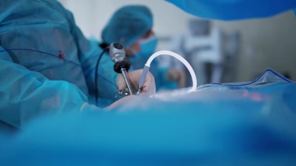 Dispositivo Médico Moderno Nas Mãos Cirurgião Durante Cirurgia Especialista Realizando — Vídeo de Stock