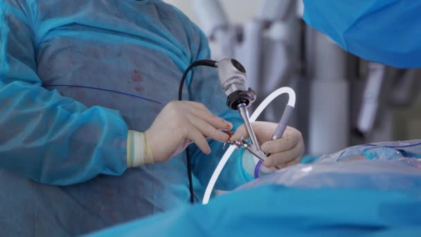신장에 복강경 현대적인 장비를 장갑을 외과의사의 클로즈업 — 비디오