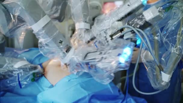 Cirugía Robótica Mínimamente Invasiva Quirófano Robot Médico Quirúrgico Operando Paciente — Vídeo de stock