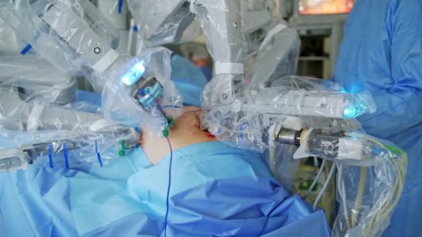 Sebészeti Eljárás Roboteszközzel Futurisztikus Gép Végzi Bonyolult Műtétet Minimálisan Invazív — Stock videók