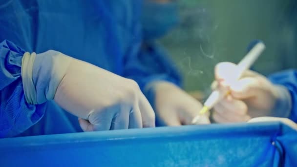 医師の手の中にある手術器具 作業中に軽い煙が上がった 集中治療ユニットの外科手順 クローズアップ — ストック動画