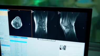 Bilgisayar tomografi resimlerini gösteriyor. Ekranda hastanın kemikleri görünüyor. Tıp çalışanı laboratuvar odasında MRI testinin sonuçlarını analiz ediyor..