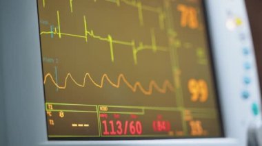 ECG monitörü ameliyathanede. Hastanedeki ameliyat sırasında ekranda renkli dalgalar belirdi. Yakın plan..