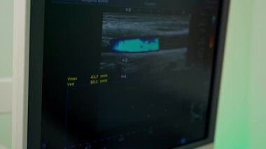 Ekranda ultrason teşhisi var. Monitörde ultrason muayenesi sırasında hastanın organının resimleri görülüyor. Klinikte modern ekipman.