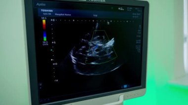 Ultrason ekranda. Tıbbi monitör ultrason araştırması sırasında hasta bir hastanın organını gösteriyor. Yakın plan..