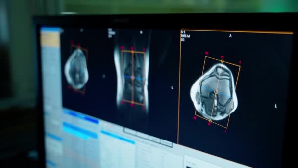 监视器上的X光片在医疗控制室的Mri机器的背景下 电脑上病人骨头的图片 后续行动 — 图库视频影像