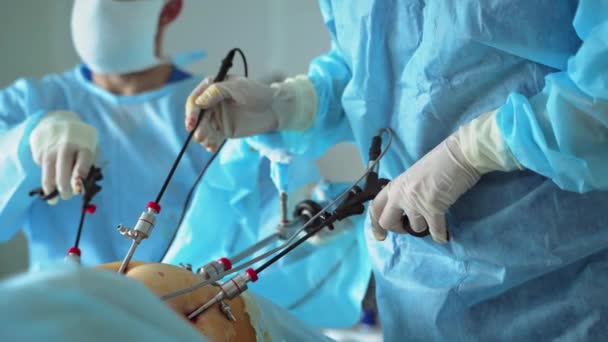 拥有手术器械的专业医生 外科医生戴着无菌手套的手在外科手术中与现代医疗工具一起工作 为病人做手术的外科医生 — 图库视频影像