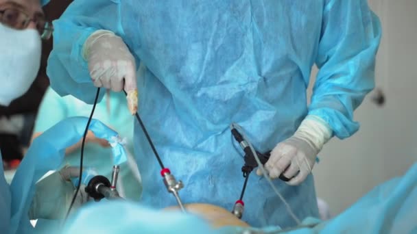 医生手中的医疗仪器 医院的操作过程 医生用手术器械做手术的手 后续行动 — 图库视频影像