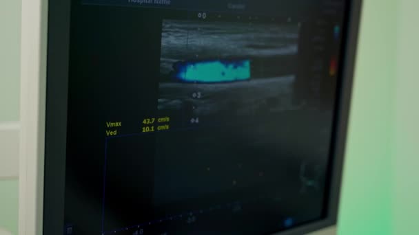Ekran Wyświetla Diagnostykę Ultradźwiękową Monitor Pokazuje Zdjęcia Organów Pacjenta Podczas — Wideo stockowe