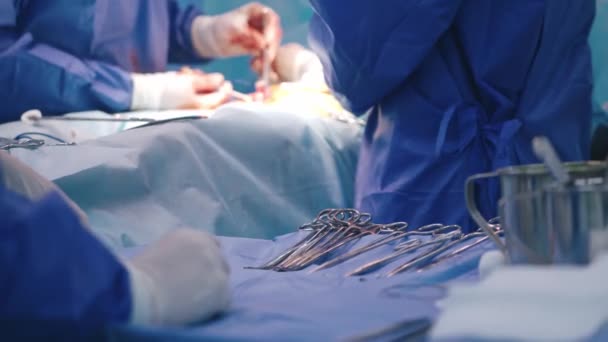 操作の背景にある手術ツール 医療チームは 手術室でハサミで操作を行っています 外科手術プロセス 医療機器について クローズアップ — ストック動画