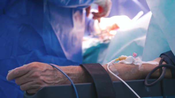 外科手術について 病院での手術プロセスの背景にある包帯および医療パイプを有する人間の手 外科治療コンセプト — ストック動画