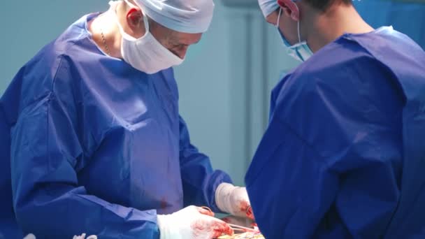 Операционный Процесс Хирургов Врачи Выполняют Операции Хирургическими Инструментами Специалисты Работают — стоковое видео