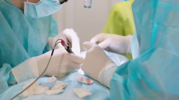 Sebészi Eljárás Orvosok Kesztyűjében Lévő Kezek Orvosi Eszközökkel Végzik Műtétet — Stock videók