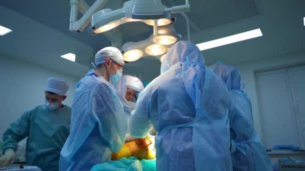 Teatr Operacyjny Zespół Lekarzy Wykonujący Operację Pacjentowi Leżącemu Stole Operacyjnym — Wideo stockowe
