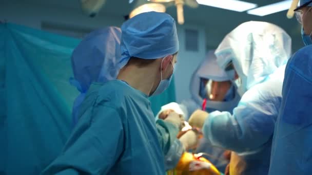 一组做外科手术的医务工作者 手术室实施伤害手术的专业医生小组 — 图库视频影像