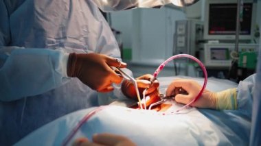 Doktorun elindeki cerrahi aletler. Cerrah modern hastanedeki bir hastaya ameliyat sırasında tıbbi aletler ve borular kullanıyor. Yakın plan..