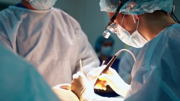 整形手术一组专家给病人做手术 女医生在手术过程中使用医疗工具 手术过程中仪器发出的轻烟 — 图库视频影像
