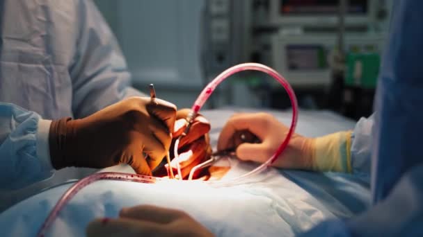 수술이요 도구로 환자를 수술하는 장갑을 외과의사의 수술실에 피가있는 파이프 클로즈업 — 비디오
