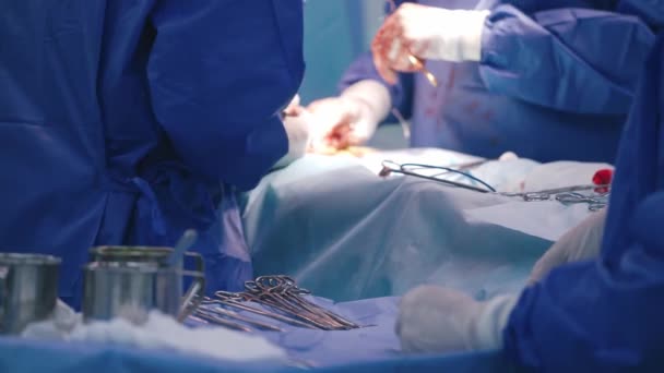 Медицинские Ножницы Заднем Плане Врачи Делают Операцию Перчатки Специалистов Крови — стоковое видео