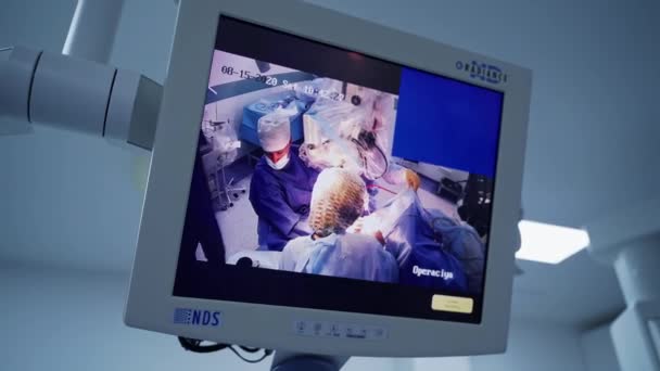 Медицинские Мониторы Операционной Командная Работа Хирургов Экране Внутренние Органы Дисплее — стоковое видео