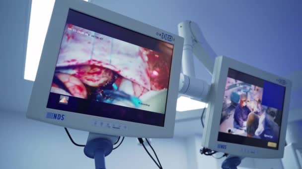 Lékařské Monitory Ukazují Operaci Vnitřní Orgány Lékařským Nářadím Displeji Neurochirurgický — Stock video