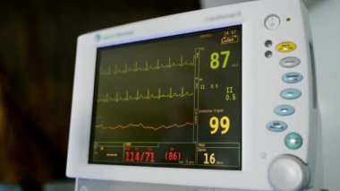Monitörde hastanın hayati belirtileri görülüyor. Ameliyathanedeki monitörde elektrokardiyogram var. Kalp monitörü. Elektrokardiyografi.