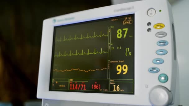 Monitor Wykazuje Oznaki Życiowe Pacjenta Elektrokardiogram Monitorze Sali Operacyjnej Monitorowanie — Wideo stockowe