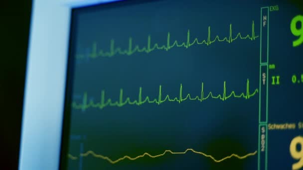 Pohyb Grafiky Obrazovce Monitoru Monitor Ukazuje Pacientovy Životní Funkce Ekg — Stock video