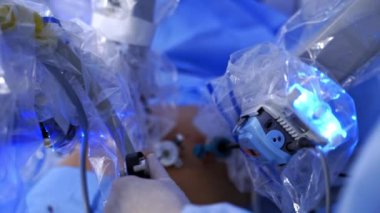 Robot kollar ameliyat yapıyor. Doktorun steril eldivenli elleri ameliyathanede modern tıbbi ekipman kullanıyor. Minimum invaziv robot operasyonu. Yakın plan..