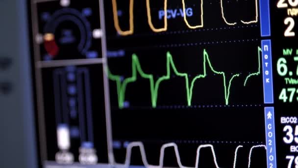 Beteg Állapota Egészségügyi Monitoron Életjelek Aneszteziológiai Sebészeti Monitoron Intenzív Osztályon — Stock videók