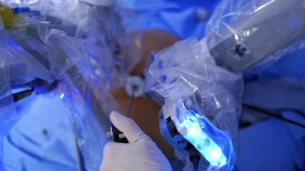 外科手術について ロボット手術中に 手を不妊手袋に入れてる 外科医は病院で最新の医療機器を使用して手術を行います クローズアップ — ストック動画