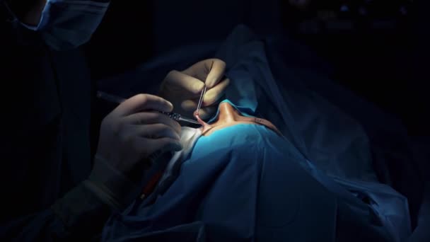 Blepharoplastyka Ręce Chirurgów Rękawiczkach Robiących Operacje Plastyczne Kobiecych Powiekach Zbliżenie — Wideo stockowe